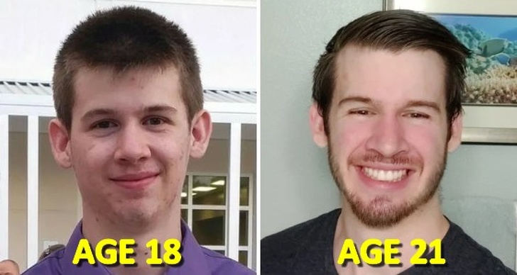 beard - Age 18 Age 21