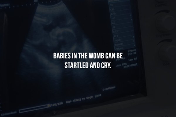 start up peru - Babies In The Womb Can Be Startled And Cry. se ne Det to be print