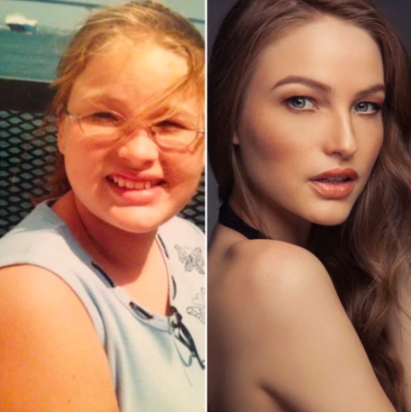 ugly duckling woman glow up