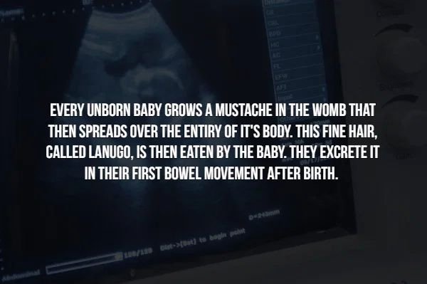 multimedia - Every Unborn Baby Grows A Mustache In The Womb That Then Spreads Over The Entiry Of It'S Body. This Fine Hair, Called Lanugo, Is Then Eaten By The Baby. They Excrete It In Their First Bowel Movement After Birth. DA > to moglo pot