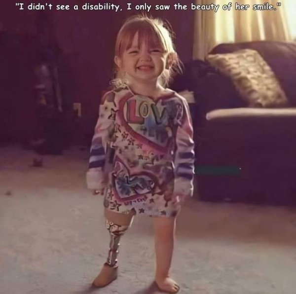 "I didn't see a disability. I only saw the beauty of her smile." Los sor