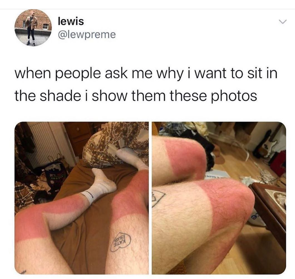 foot - lewis when people ask me why i want to sit in the shade i show them these photos