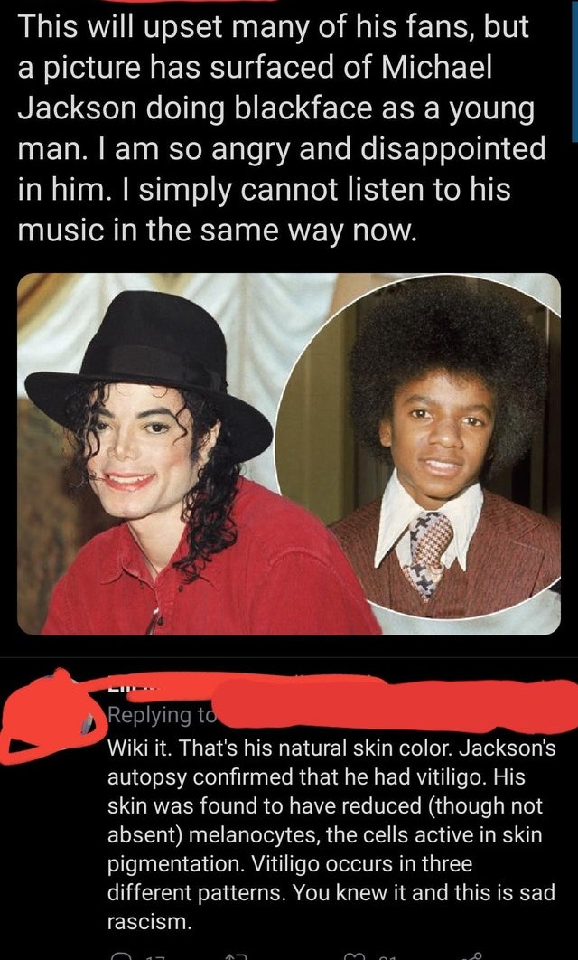 photo caption - This will upset many of his fans, but a picture has surfaced of Michael Jackson doing blackface as a young man. I am so angry and disappointed in him. I simply cannot listen to his music in the same way now. Wiki it. That's his natural ski