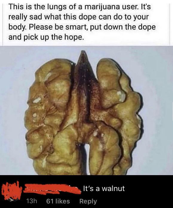 lungs of a marijuana user - This is the lungs of a marijuana user. It's really sad what this dope can do to your body. Please be smart, put down the dope and pick up the hope. It's a walnut 13h 61