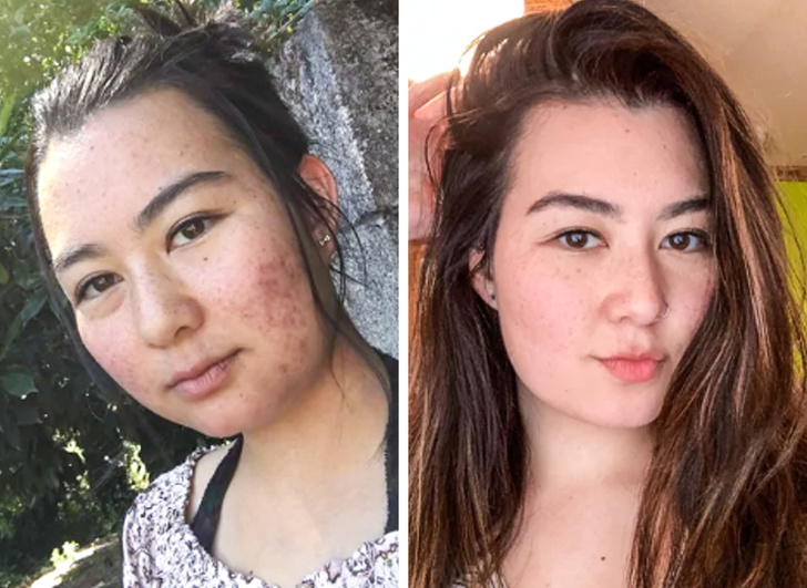 21 Ugly Ducklings Who Grew Up.