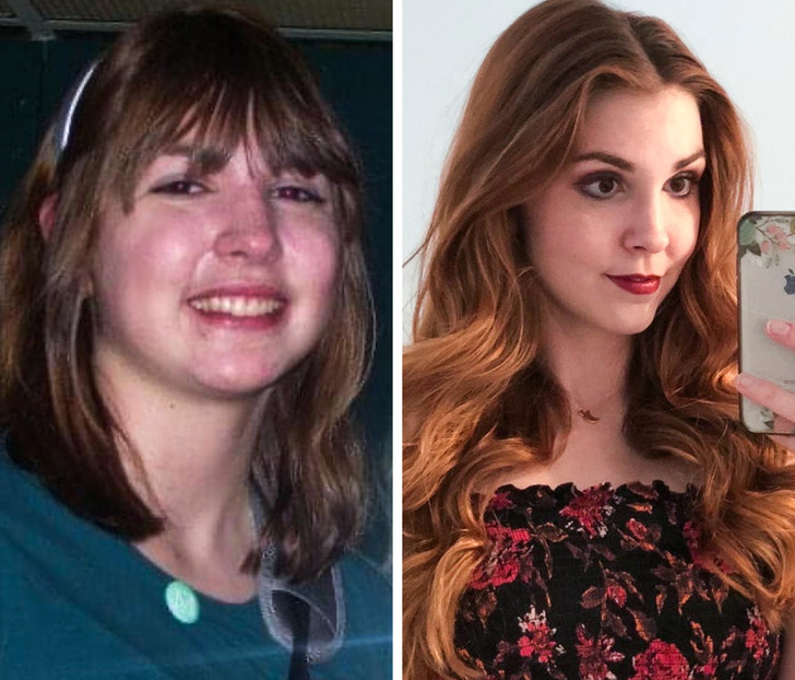 21 Ugly Ducklings Who Grew Up.