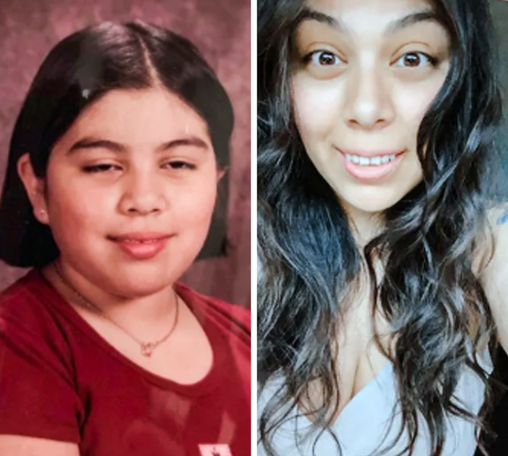 21 Ugly Ducklings Who Grew Up.