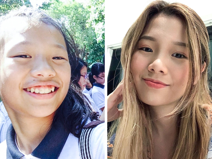 21 Ugly Ducklings Who Grew Up.