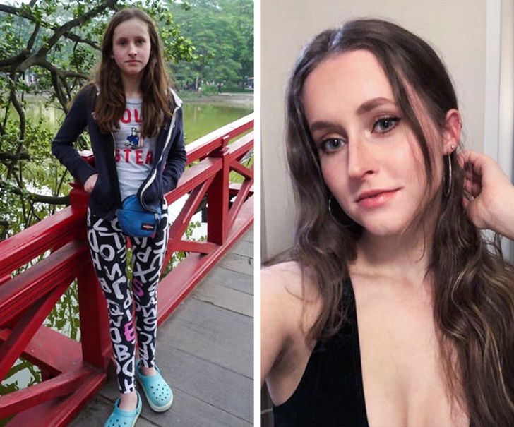 21 Ugly Ducklings Who Grew Up.