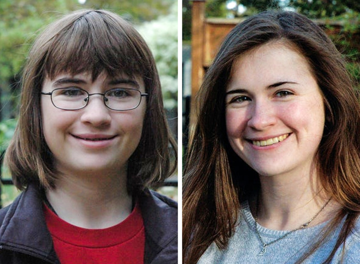 21 Ugly Ducklings Who Grew Up.