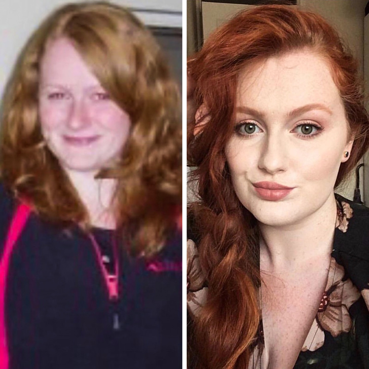 21 Ugly Ducklings Who Grew Up.