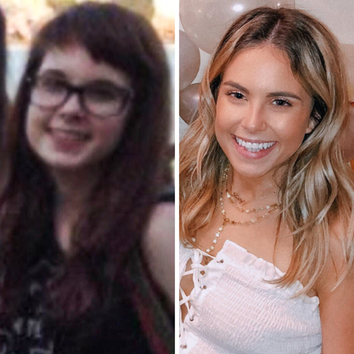 21 Ugly Ducklings Who Grew Up.