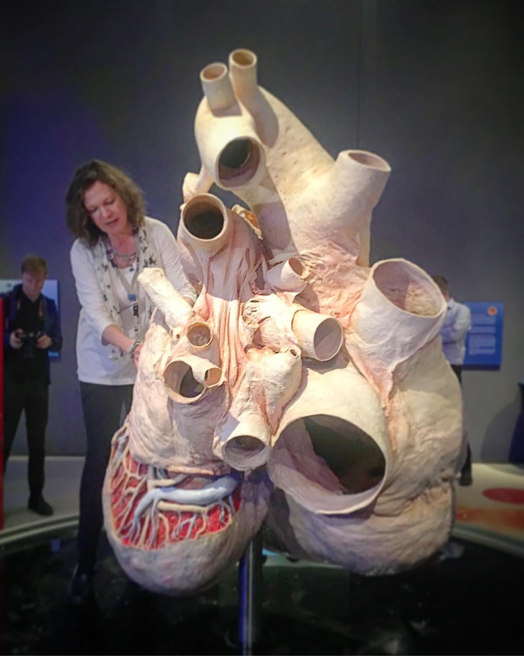 A blue whale heart weighs around 400 lb and can be up to 5 feet long.