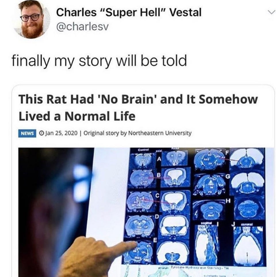 rat had no brain - Charles "Super Hell" Vestal finally my story will be told This Rat Had 'No Brain' and It Somehow Lived a Normal Life News Original story by Northeastern University Control B C D corona E Tote Boxase St.Th