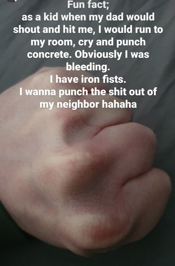 close up - Fun fact; as a kid when my dad would shout and hit me, I would run to my room, cry and punch concrete. Obviously I was bleeding. I have iron fists. I wanna punch the shit out of my neighbor hahaha