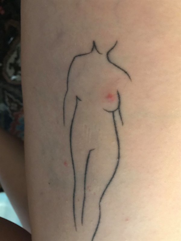 tattoo with bug bite nipple