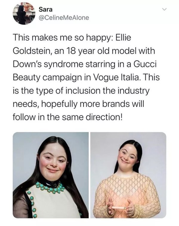 Down syndrome - Sara MeAlone This makes me so happy Ellie Goldstein, an 18 year old model with Down's syndrome starring in a Gucci Beauty campaign in Vogue Italia. This is the type of inclusion the industry needs, hopefully more brands will in the same di