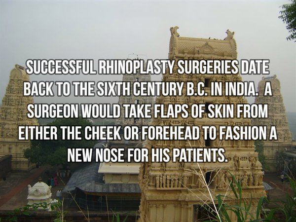 ferrari s.p.a. - Successful Rhinoplasty Surgeries Date Back To The Sixth Century B.C. In India. A Surgeon Would Take Flaps Of Skin From Either The Cheek Or Forehead To Fashion A New Nose For His Patients.
