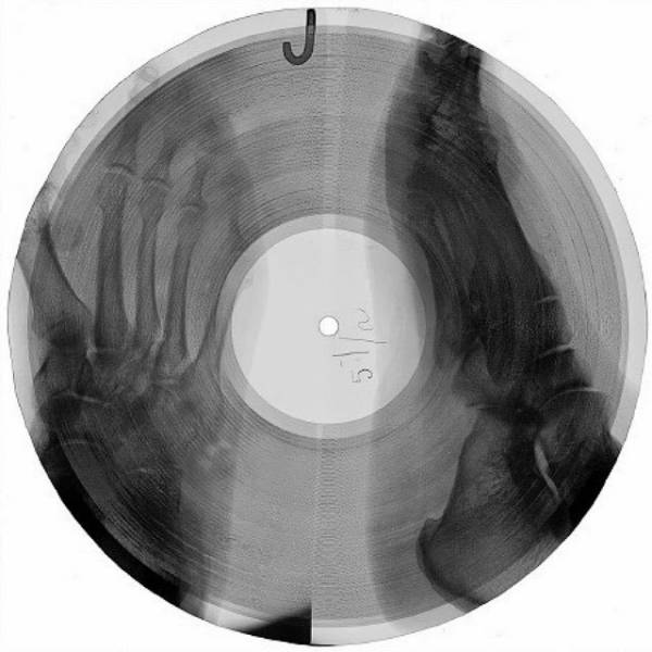 x ray vinyl - che