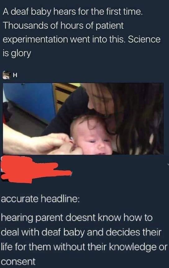 photo caption - A deaf baby hears for the first time. Thousands of hours of patient experimentation went into this. Science is glory H accurate headline hearing parent doesnt know how to deal with deaf baby and decides their life for them without their kn