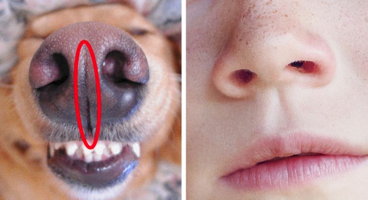 That little crack that runs from the top of your lip to your nose is called a medial cleft or philtrum (and some animals have them too).