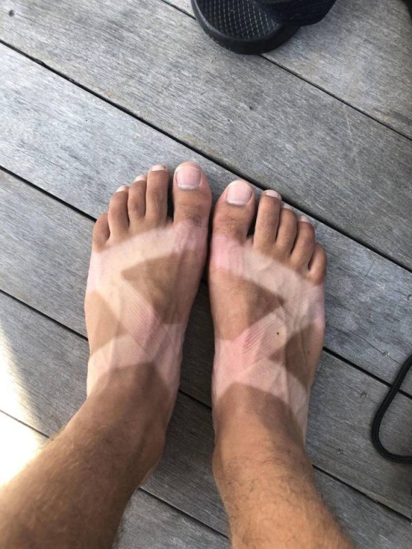 toe