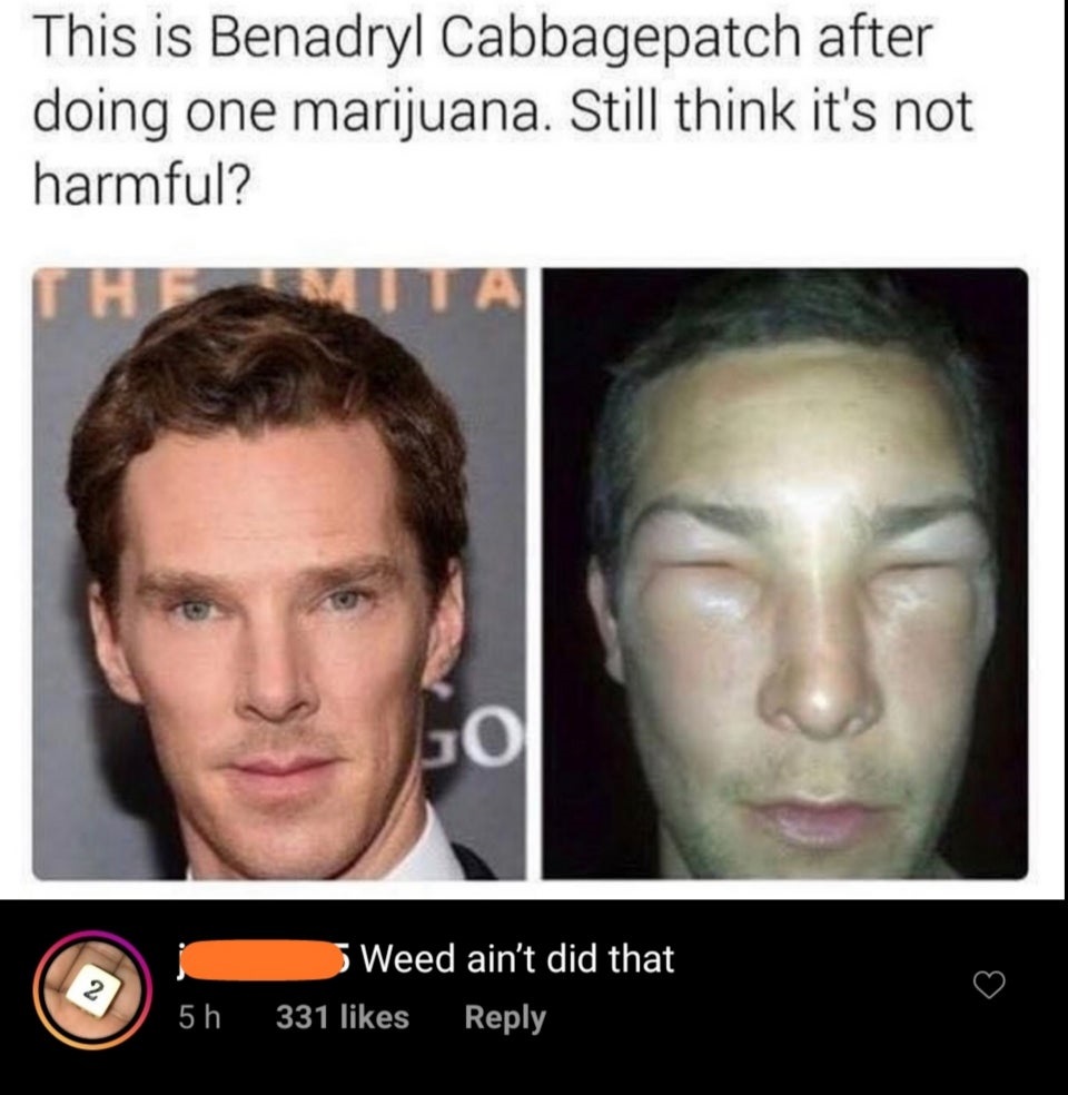 missed the joke - benedict cumberbatch meme - This is Benadryl Cabbagepatch after doing one marijuana. Still think it's not harmful? Jo Weed ain't did that 331 5 h