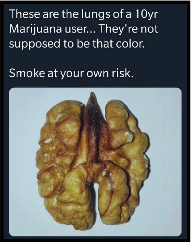thats wack - These are the lungs of a 10yr Marijuana user... They're not supposed to be that color. Smoke at your own risk.