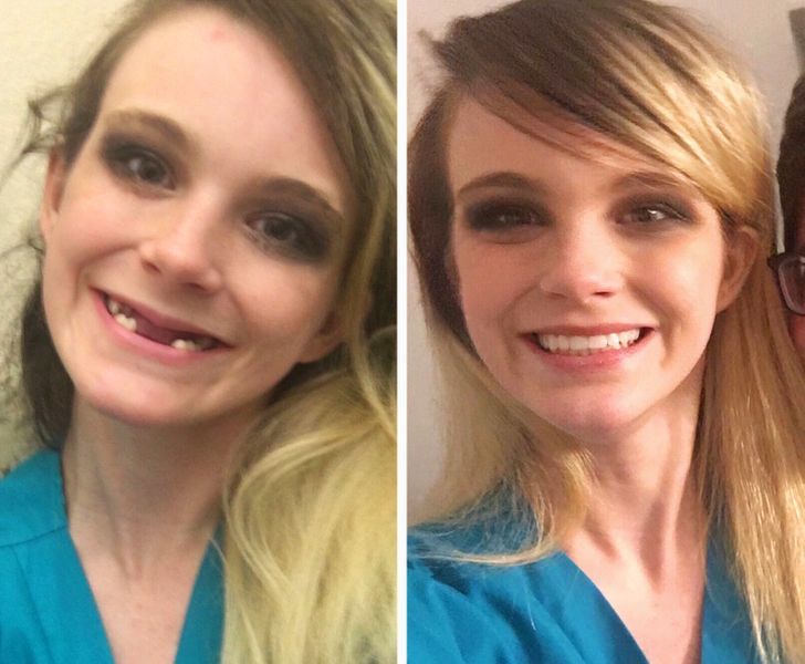 20 People Who Made Amazing Transformations in Their Lives. - Wow