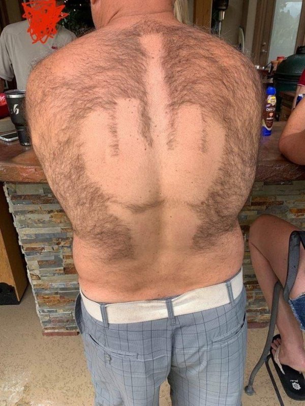 guy with middle finger shaved into his back hair