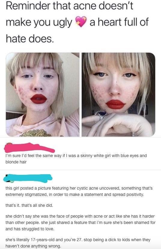 funny feminist fails - Reminder that acne doesn't make you ugly a heart full of hate does. I'm sure I'd feel the same way if I was a skinny white girl with blue eyes and blonde hair this girl posted a picture featuring her cystic acne uncovered, something