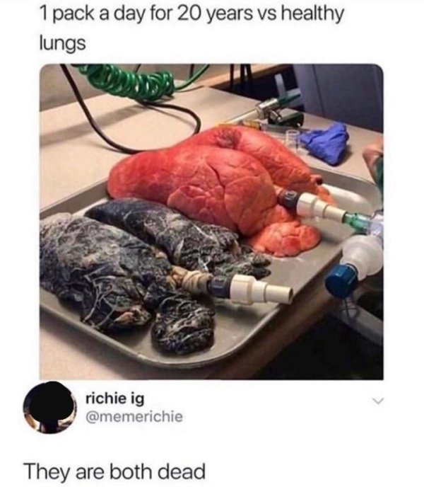 lungs but they are both dead - 1 pack a day for 20 years vs healthy lungs richie ig They are both dead