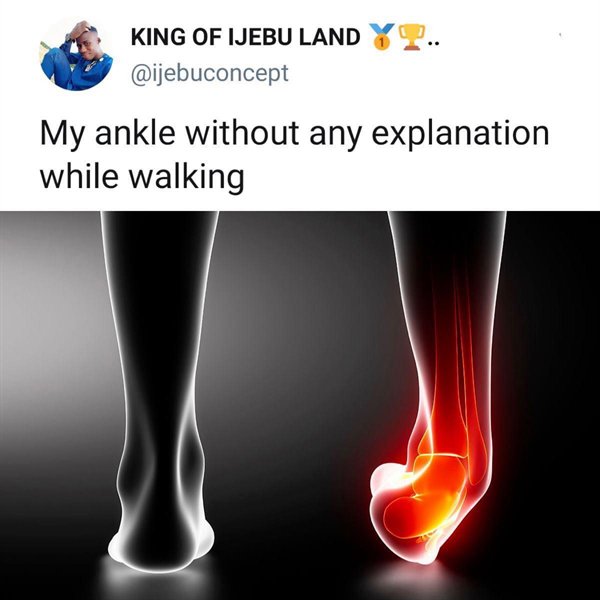 strains & sprains - King Of Ijebu Land My ankle without any explanation while walking