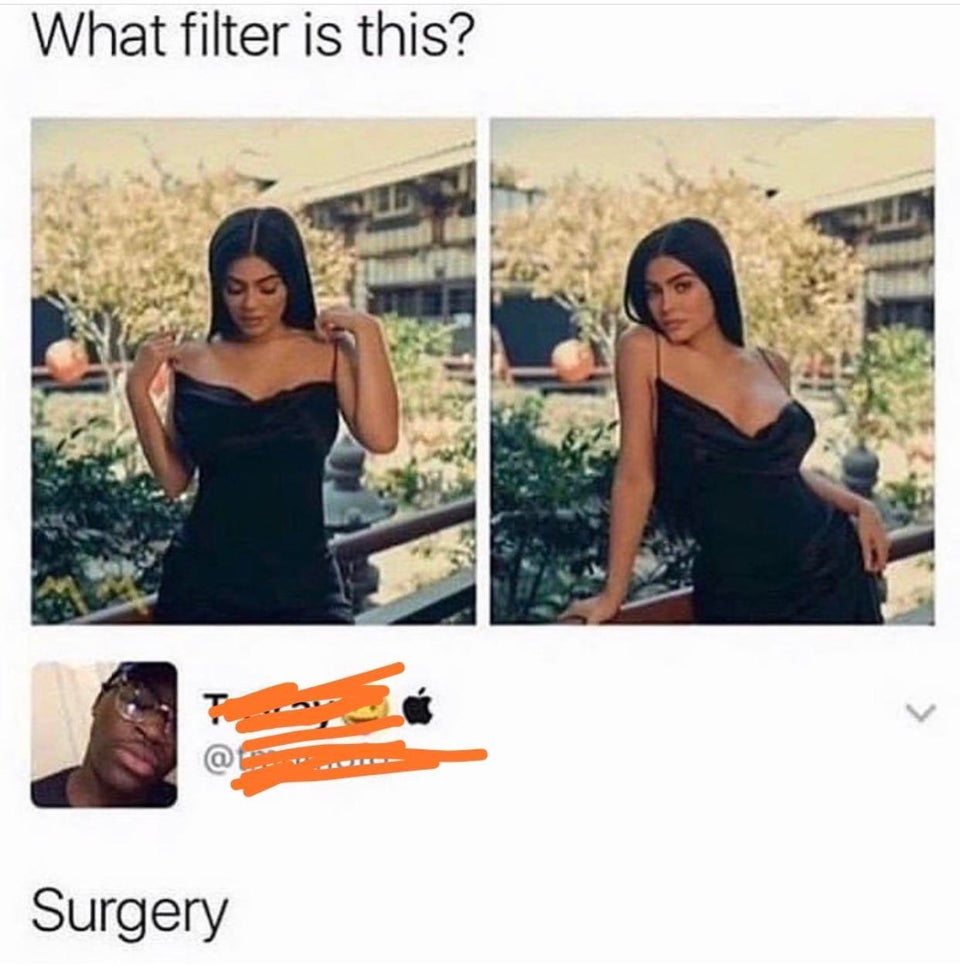 Kylie Jenner - What filter is this? Surgery