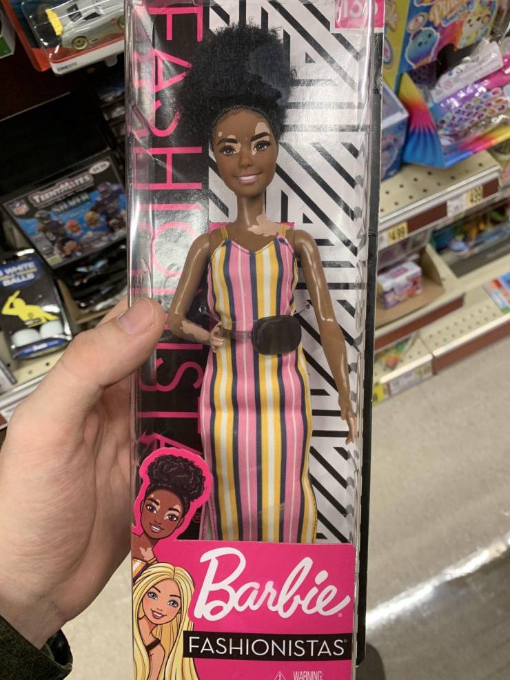 “This Barbie doll with Vitiligo.”