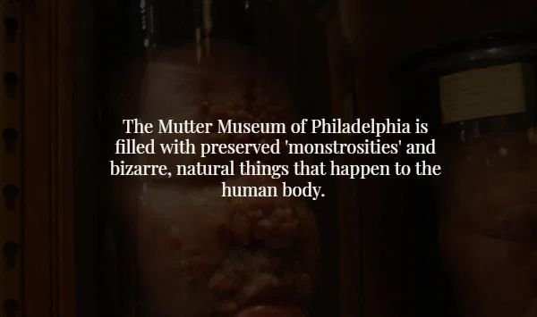 durable packaging - The Mutter Museum of Philadelphia is filled with preserved 'monstrosities' and bizarre, natural things that happen to the human body.