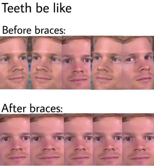 braces meme - Teeth be Before braces After braces