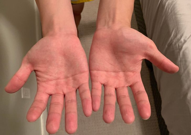 “My friend’s palms only have one line going through them.”