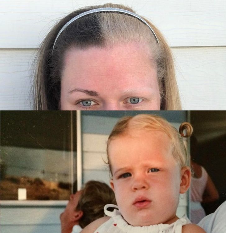 “My sister has had hair that’s half-blonde, half-brunette since she was born.”