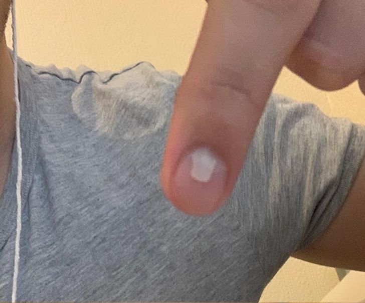 “A second nail has been growing out of my finger ever since it got trapped in a car door when I was 8.”