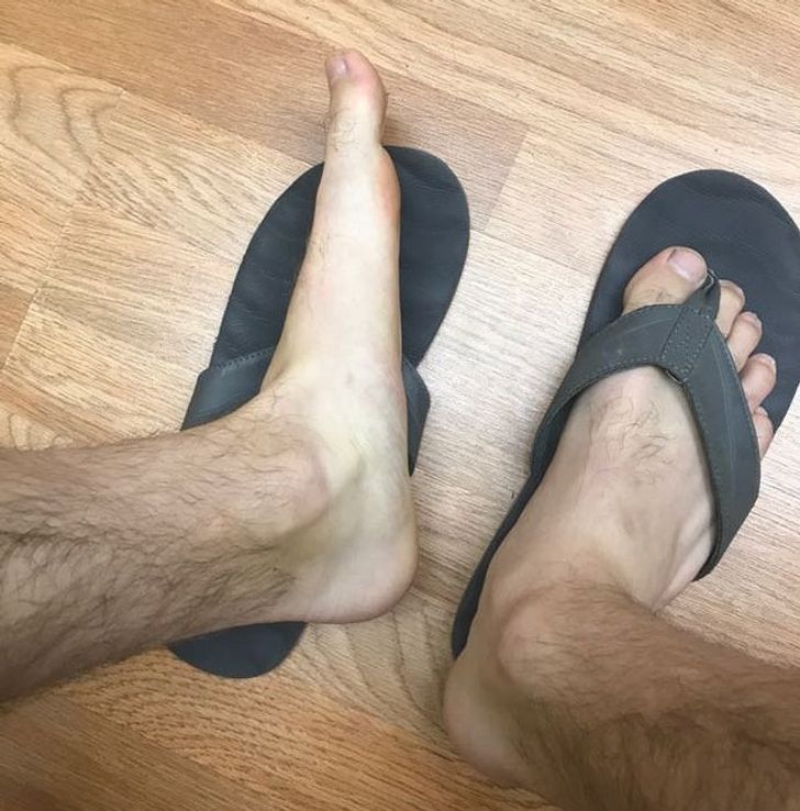 “My feet are totally flat.”