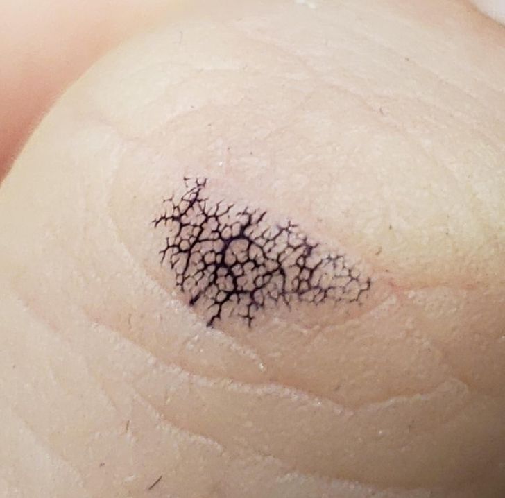 “A fading Sharpie stain on my thumb looks like the start of a deadly virus.”