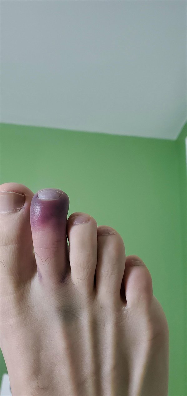 toe