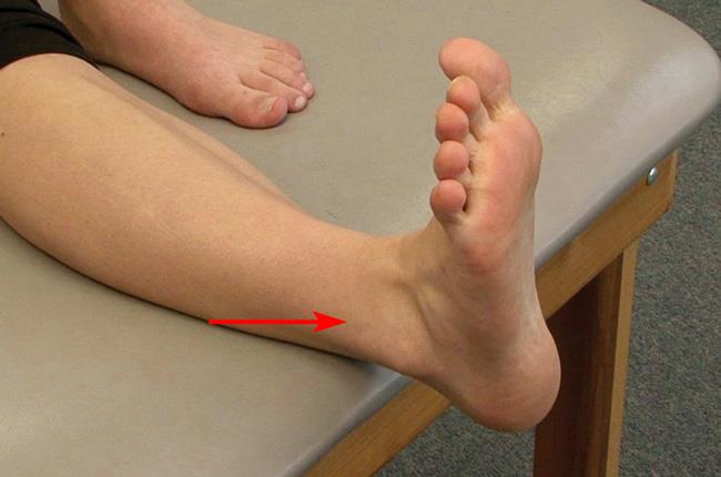 know if you sprained your ankle