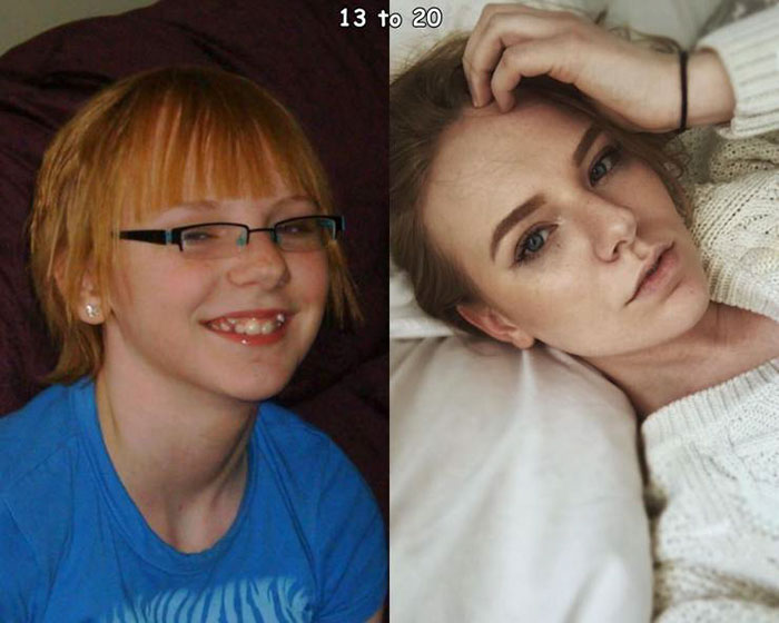 puberty hits - 13 to 20 ods