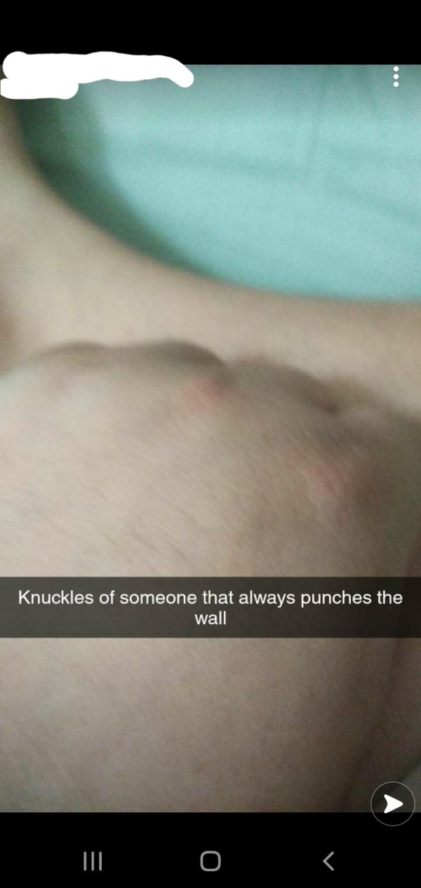 close up - Knuckles of someone that always punches the wall Iii O T