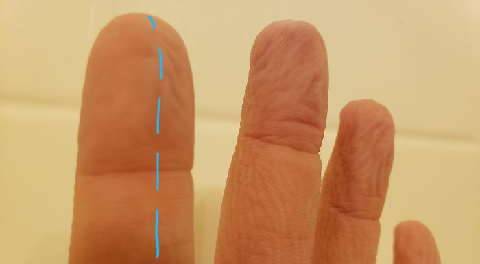 interesting pics - nerves in index finger water pruning