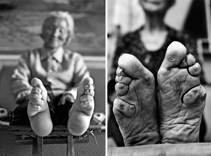 foot binding in china