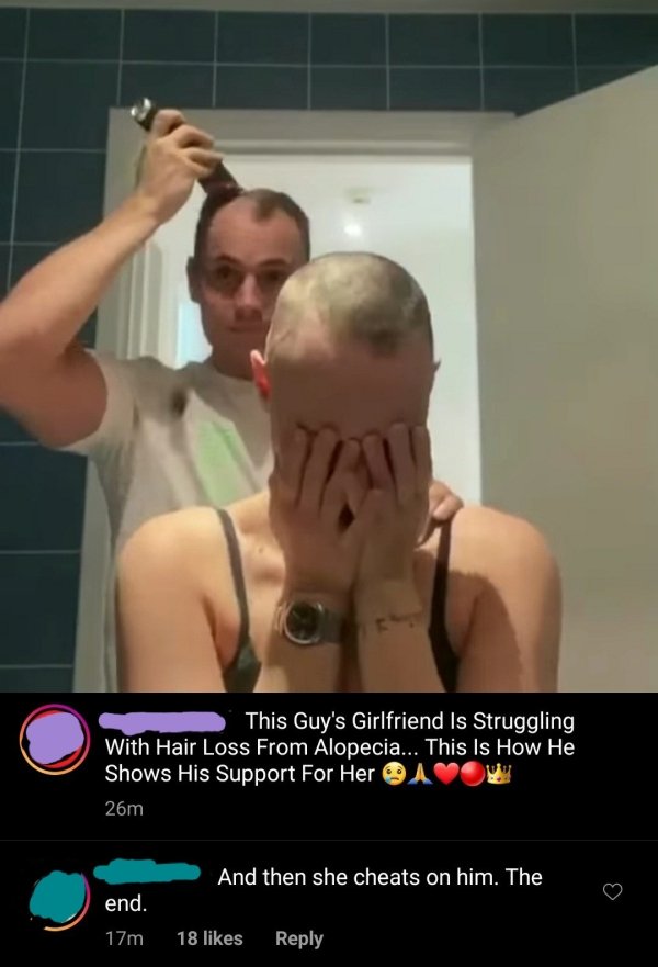 This Guy's Girlfriend Is Struggling With Hair Loss From Alopecia... This Is How He Shows His Support For Her Aow 26m And then she cheats on him. The end. 17m 18