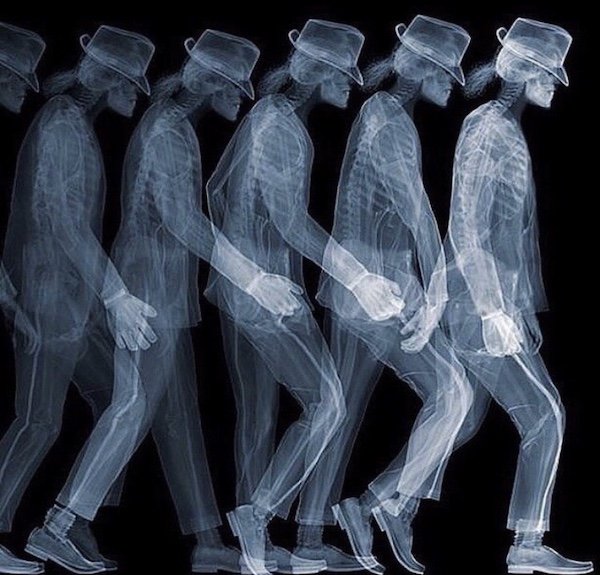 funny memes - X-ray michael jackson moon walk
